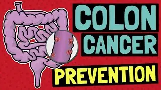 The Surprising Link Between Starch and Colon Cancer Prevention