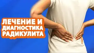 Диагностика и лечение РАДИКУЛИТА // #zdravclinic