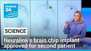 US FDA approves Neuralinks brain chip implant for second patient • FRANCE 24 English