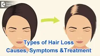 Types of Hair Loss | Common Causes, Symptoms & Treatment - Dr. Kavitha GV Mandal