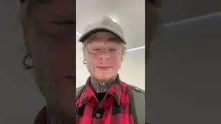 Удалили тату с лица Дани Белого 🤟😎