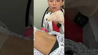 Asmr abdominal 