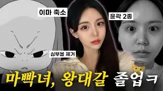 나보다 얼굴 동그란 사람 나와봐 | 이마축소 + 윤곽2종 + 심부볼제거 (4개월 차 리얼후기)