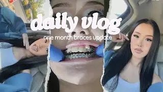 Braces Vlog Ep.3: ONE MONTH BRACES UPDATE + come with me to my orthodontist vlog♡