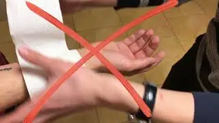 Оказание первой помощи при термическом ожоге первой степени