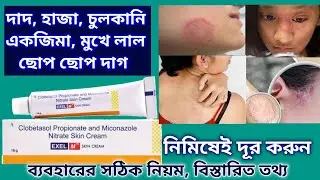 Exel m ! Exel m cream কি, কি কাজ করে। কোন রোগের ঔষধ সম্পূর্ণ তথ্য Exel ! clobetasol propionate