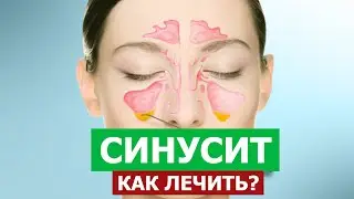 Всё о синусите ! Целитель Махачкала.