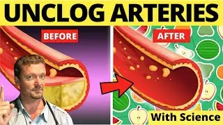 Top Foods to Clean Arteries & Prevent Heart Attack! (Sarcasm Alert!)