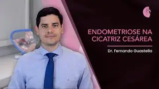 ENDOMETRIOSE NA CICATRIZ CESÁREA | EXPLICAÇÃO DO ESPECIALISTA | Dr Fernando Guastella