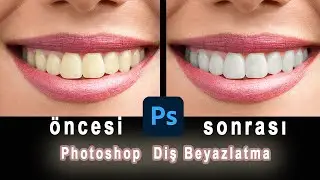 Photoshop  Diş Beyazlatma