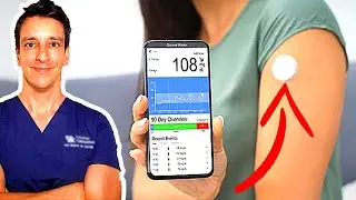 Should you wear a Continuous Glucose Monitor (CGM)?