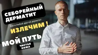 Себорейный дерматит. Мой путь полного излечения с пошаговой инструкцией! Как избавится от себореи?