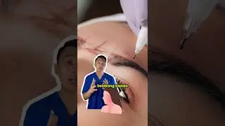 Ngilangin tattoo itu sakit ga sih? | laser tattoo removal! 