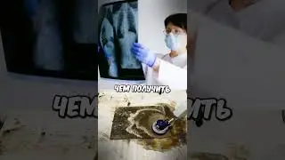 Опасные Челленджи MrBeasta…