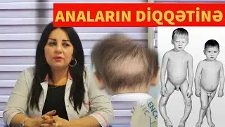 UŞAQLARDA D VİTAMİNİ ƏKSİKLİYİ RAXİT XƏSTƏLİYİNƏ YOL AÇAR