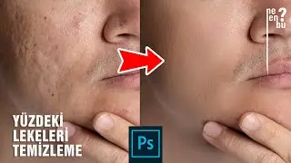 Yüzdeli Lekeleri ve Kırışıklıkları Temizlemek - Photoshop Eğitim Dersleri