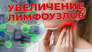 Почему увеличиваются ЛИМФОУЗЛЫ! Лимфоденопатия. Как оценить лимфоузлы самостоятельно.