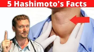 HASHIMOTOS Thyroiditis: (5 Things YOU Need to Know) 2024