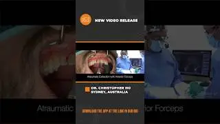 Immediate Tooth Replacement with Implant Placement and Temporization