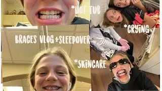 Braces vlog