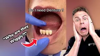 This Is What Happens If You NEVER Brush Your Teeth! 😳