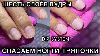 НОГТИ ТРЯПОЧКИ 
