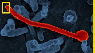 Tout comprendre sur : Ebola