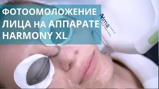 😍 О процедуре фотоомоложения лица на аппарате Harmony XL. Фотоомоложение лица. Лечебный центр. 18+