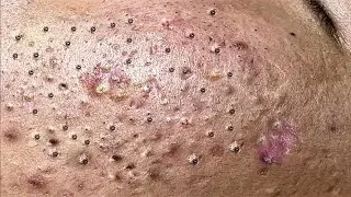 Most Satisfying and Relaxation with An Spa Video 