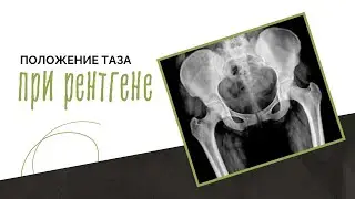 Положение тела при рентгене