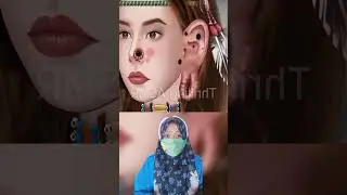 Kompilasi Kumpulan Asmr Animasi luka infeksi dari berbagai penyebab |Mv 