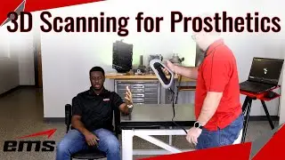 3D Scanning for Prosthetics and Braces