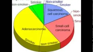 mesothelioma survival rates usa