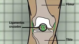 Técnica diminui dor após cirurgia de joelho