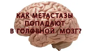 Метастазы! Опухоль! Рак в мозгу !Как и чем лечить?