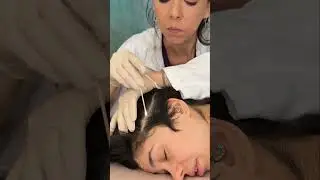 Asmr scalp tingles #asmr #asmrsounds #asmrvideo #relax #relaxing #satisfying #hair #sleep #tingles