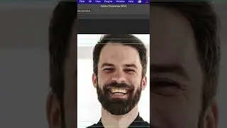 Photoshop 30 Saniyede Diş Beyazlatma