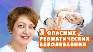 ТОП-3 ревматических заболеваниях, которые НЕЛЬЗЯ игнорировать! // #zdravclinic