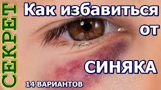 Как избавиться от синяка