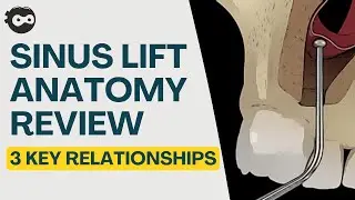 Sinus Lift Anatomy Review | 3 Key Relationships