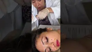 Asmr scalp ✏️ 