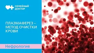 Плазмаферез – метод очистки крови.