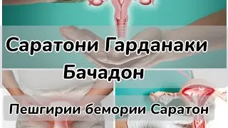 БЕМОРИИ САРАТОН (РАК) ДАР ЗАНХО. 