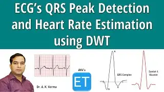 ECG QRS Peak Detection and Heart Rate Estimation using DWT
