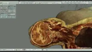 The Visible Human in real-time with Blender