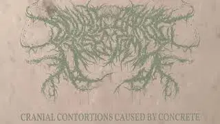 Double-Barrel Vasectomy - Lost Tracks