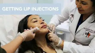 Juvederm Lip Injections with Dr. Usha Rajagopal | San Francisco