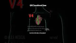 QRS Transitional Zone and R-Wave Progression #medicalanimation #ekg #ecg #3danimation #cardiology