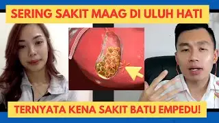 SAKIT MAAG DI ULUH HATI GA SEMBUH SEMBUH? HATI HATI BATU EMPEDU!