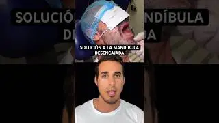 This is what you have to do if your JAW is DISCOLATED - Solution with the NELATON Maneuver